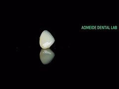 Cây cầu vương miện gốm