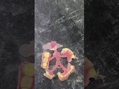 Nesbit Denture linh hoạt cho sự thoải mái và bền trong thay thế răng