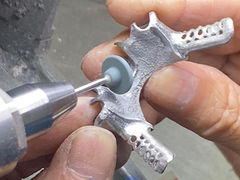 Rửa răng một phần