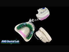 Một loạt các giải pháp chỉnh nha tùy chỉnh được chế tạo với độ chính xác, sự thoải mái và sự cẩn thận.