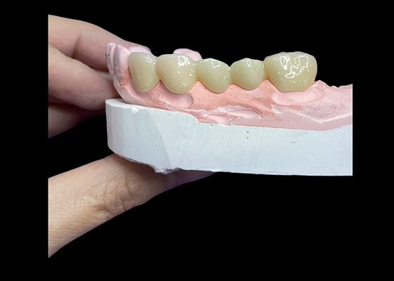 Mua Tất cả các vương miện và cầu gạch gốm được thiết kế cho tính thẩm mỹ vượt trội độ bền và phù hợp tự nhiên cho sự tự tin lâu dài online manufacture