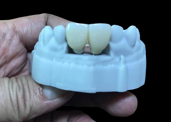 Mua Thay đổi vương miện cấy ghép răng bị thiếu bằng vít Titanium Base và Zirconia Crown online manufacture