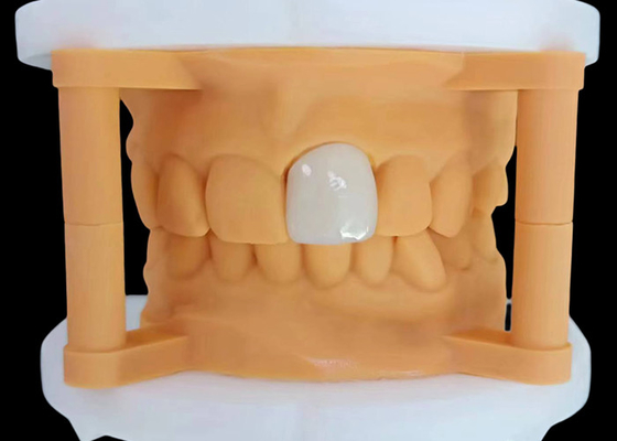 Mua Vương miện răng Zirconia xuyên suốt với hiệu suất thẩm mỹ từ Phòng thí nghiệm nha khoa Trung Quốc online manufacture