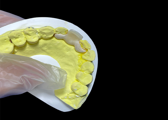Mua Dental Ceramic Crown HPP Bonded Ceramic Bridge Dễ dàng làm sạch online manufacture