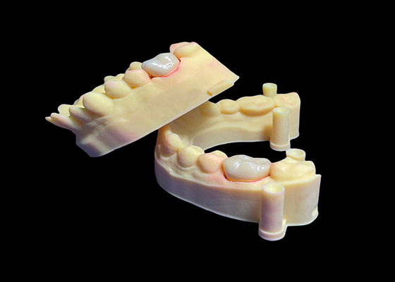 Mua Vương miện Zirconia nha khoa tương thích sinh học cho răng đơn / nhiều răng có độ bền cao online manufacture