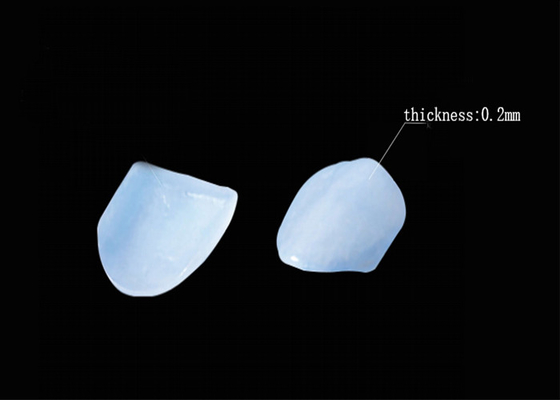 Mua Hình dáng nha khoa EMAX Porcelain veneers cho restorations răng đẹp online manufacture