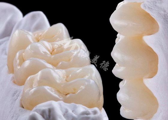 Mua Vương miện răng Zirconia bền cao cho thay thế răng đơn hoặc nhiều răng online manufacture