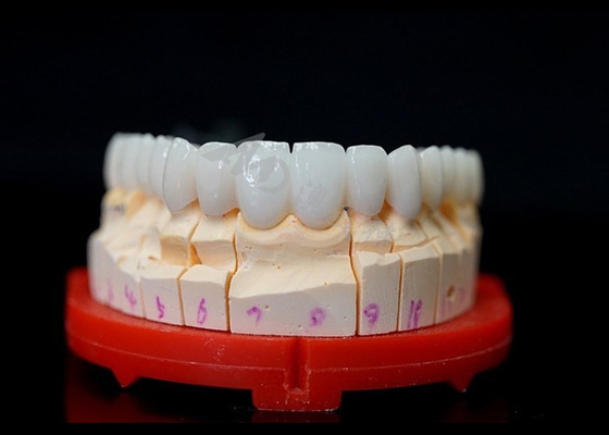 Mua Vương miện Zirconia hoàn chỉnh, rất tương thích sinh học cho răng online manufacture