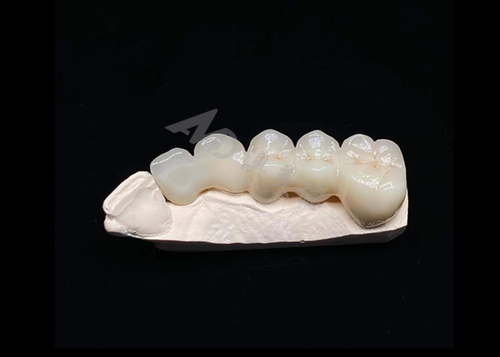 Mua Màn hình xuyên suốt Vẻ đẹp tự nhiên Vương miện Zirconia rắn cho răng Kháng vỡ online manufacture