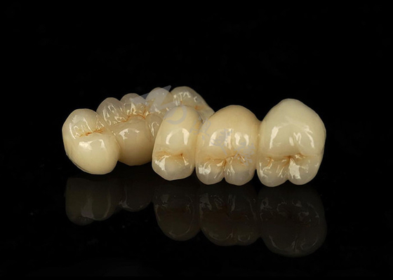 Mua Vương miện Zirconia rắn chống vết bẩn kết hợp khả năng tương thích sinh học tuyệt vời online manufacture