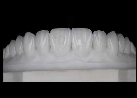 Mua Màn hình xuyên mạc Địa chất thiên nhiên Circonia vương miện Tốt nhất Biocompatibility Và Sức mạnh online manufacture