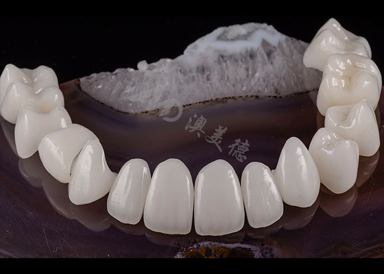 Mua Răng xuyên suốt răng rắn Zirconia Crown Aesthetics tự nhiên Kháng vỡ online manufacture