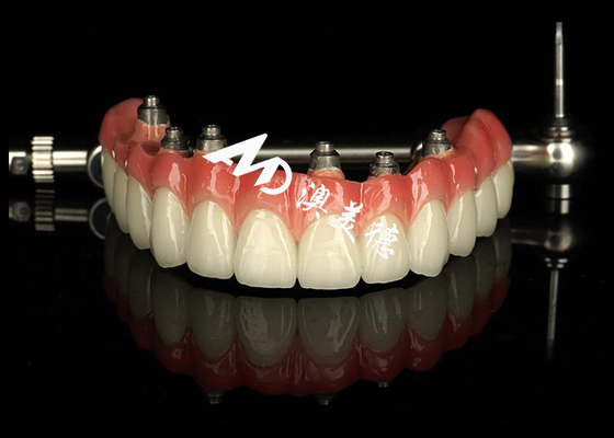 Mua Tùy chỉnh nha khoa cấy ghép hỗ trợ răng giả Crown Bridge cho việc bảo trì răng thiếu online manufacture