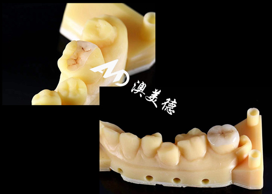 Mua Đồ cẩm thô chính xác và Onlays cho sửa chữa răng với màu sắc tự nhiên vật liệu hypoallergenic và phù hợp liền mạch cho sự thoải mái và độ bền vượt trội online manufacture