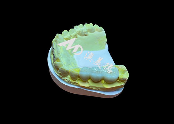 Mua Đơn vị hóa bề mặt mịn Zirconia vương miện răng cao Biocompatibility Kháng vết bẩn online manufacture