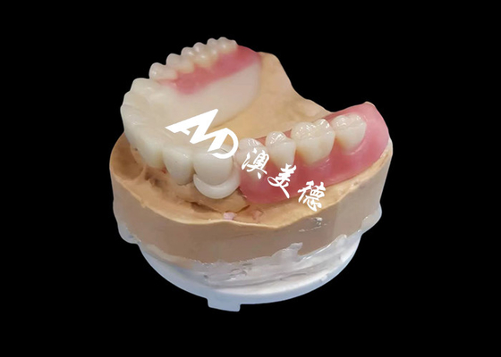 Mua Tùy chỉnh Hpp Frame Acrylic Removable phần răng giả cho răng thiếu online manufacture