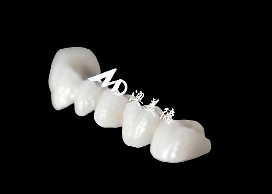 Mua Vương miện răng full arch Zriconia với ngoại hình tự nhiên đáng kinh ngạc online manufacture