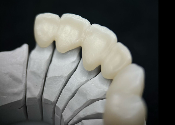 Mua Vương miện Zirconia rắn răng có sức mạnh vượt trội và thẩm mỹ tự nhiên online manufacture