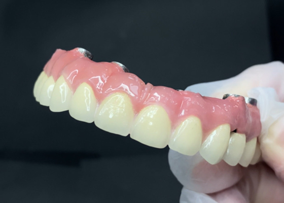 Mua Cấy ghép răng bền với lớp vỏ titan dễ làm sạch và vương miện zirconia online manufacture