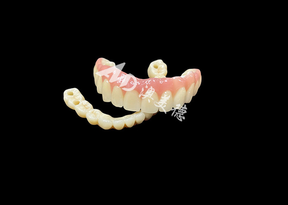 Mua Phương pháp thay thế răng giả bằng cấy ghép Đường cầu là giải pháp tuyệt vời cho răng bị mất online manufacture