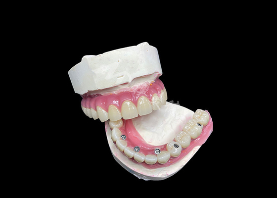 Mua Circonia Dental Implant Crown Bridge tất cả trên 6 để thay răng bị mất online manufacture