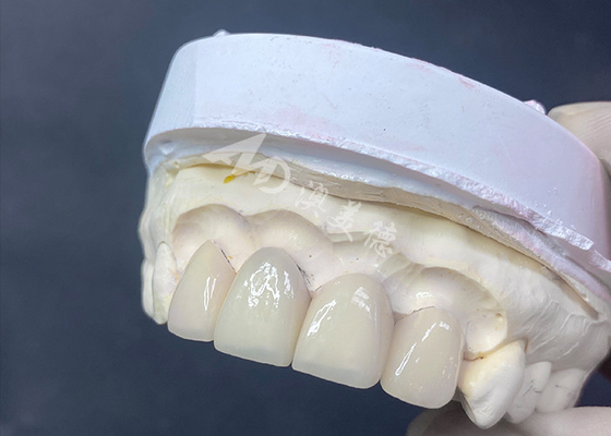 Mua Vỏ răng được chế tạo chính xác Phương pháp phù hợp tuyệt vời và xuyên suốt cao cho nụ cười hoàn hảo online manufacture