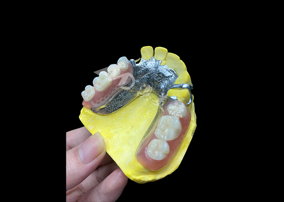 Mua Răng đúc một phần có thể điều chỉnh để tăng sự thoải mái và ổn định, hoàn hảo cho việc nhai và nói online manufacture