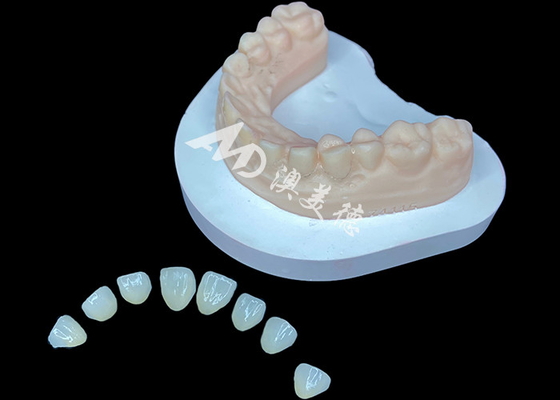 Mua IPS e.max Veneer Giải pháp thẩm mỹ cao cấp cho biến đổi nụ cười tuyệt đẹp online manufacture
