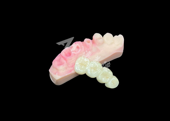 Mua Cầu vương miện cao cấp bằng Zirconia Solid cho thẩm mỹ nha khoa trông tự nhiên online manufacture