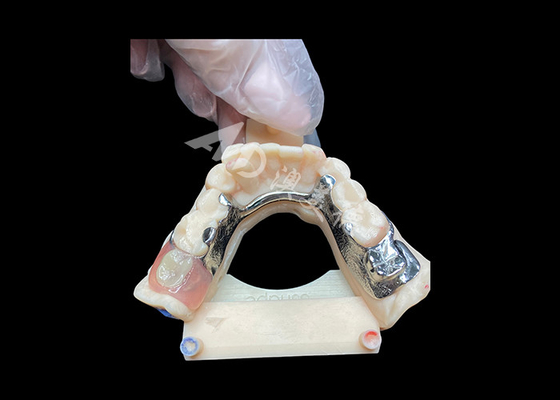 Mua Bảo trì dễ dàng đúc răng giả một phần cho sức mạnh vượt trội và hấp dẫn thẩm mỹ online manufacture