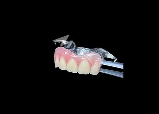 Mua Chất thay thế răng cốt lâu dài Bảo trì dễ dàng để nhai tốt hơn và nụ cười hoàn hảo online manufacture