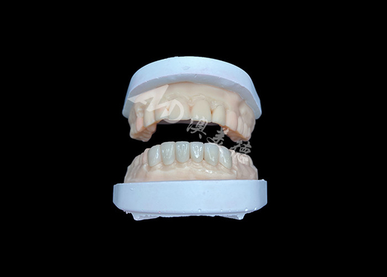 Mua IPS Emax Veneers Phục hồi trông tự nhiên cho nụ cười thẩm mỹ online manufacture