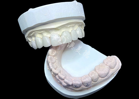 Mua IPS e.max Veneers trong bóng BL2 đạt được thẩm mỹ tự nhiên tuyệt vời online manufacture