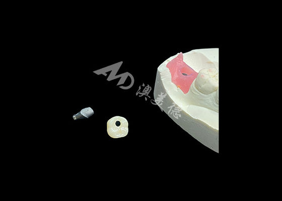 Mua Những chiếc vương miện cấy ghép nha khoa cách mạng hóa phương pháp nha khoa phục hồi online manufacture