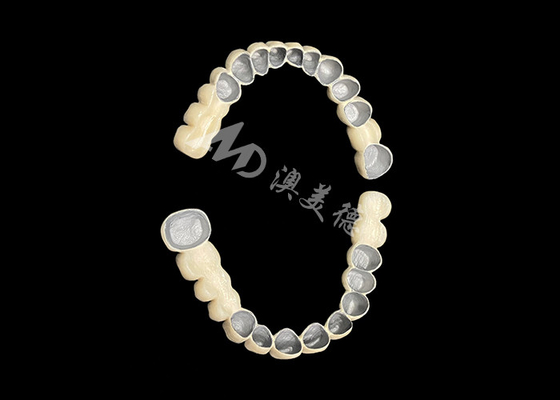 Mua Đồ xốp tùy chỉnh được hợp nhất với cây cầu vương miện răng kim loại để tăng cường nụ cười tự nhiên online manufacture