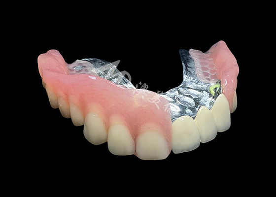Mua Cải thiện nụ cười của bạn PFM cầu vương miện trông tự nhiên và răng giả có thể tháo rời online manufacture