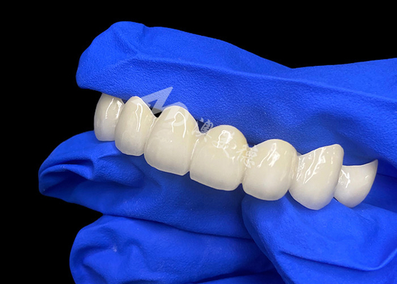 Mua Lava cao độ xuyên suốt Zirconia Dental Bridge hỗn hợp liền mạch với răng tự nhiên online manufacture