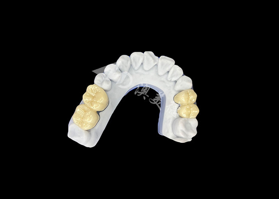 Mua Zirconia PFZ Porcelain Crown từ phòng thí nghiệm nha khoa chuyên nghiệp của Trung Quốc online manufacture