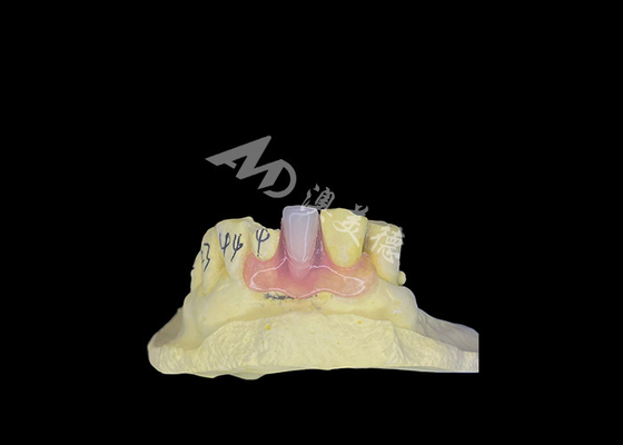 Mua Nesbit Denture linh hoạt cho sự thoải mái và bền trong thay thế răng online manufacture