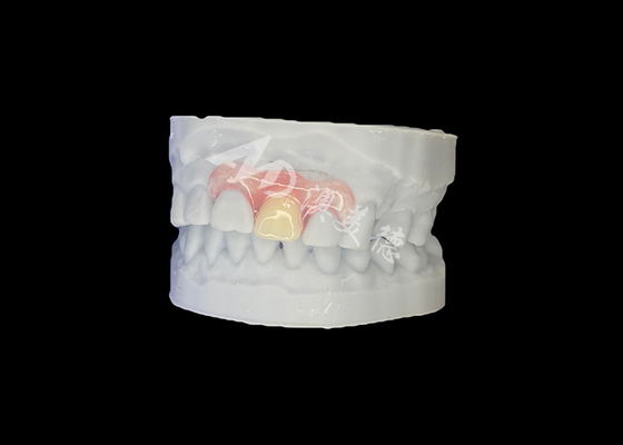 Mua Mẫu răng giả linh hoạt của Nesbit cho sự phù hợp tự nhiên và thoải mái lâu dài online manufacture