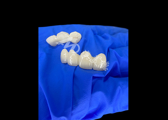 Mua Wieland Zenostar Ceramic Crown Bridge Độ chính xác cao cho khôi phục bền và tự nhiên online manufacture