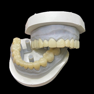 Mua PMMA Temporary Restorations CAD/CAM PMMA Crowns and Bridges for Provisional Dental Cases online manufacture