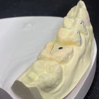 Mua Tăng Cường Phục Hồi của Bạn với Công Nghệ Lõi Chốt Pink Post online manufacture