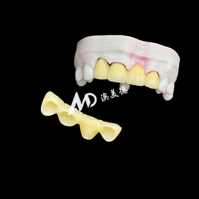 Mua Premium Ceramic Crowns and Bridges for High-Strength, Natural Aesthetics and Long-Lasting Clinical Performance online manufacture