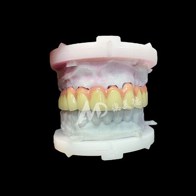 Mua Vương miện và cầu gốm Titanium tinh khiết bền nhẹ phục hồi thẩm mỹ online manufacture