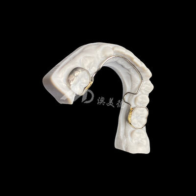 Mua Khung ngôn ngữ tùy chỉnh với băng đai Thiết bị chỉnh nha để duy trì không gian và sắp xếp răng online manufacture