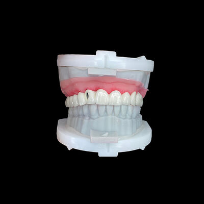 Mua Full Arch Implant Bridge với khung kim loại CoCr mạnh mẽ và lớp sứ cao cấp để phù hợp chính xác online manufacture