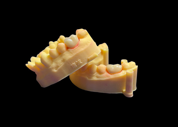 Vương miện răng bằng đồ sứ Zirconia cao cấp Sức mạnh không thể sánh kịp Chiết hợp chính xác và tính thẩm mỹ và độ bền đặc biệt