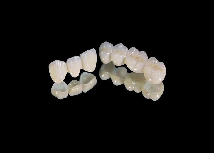 Vương miện nha khoa bằng Zirconia chống mòn với chống vết bẩn và thẩm mỹ tự nhiên từ phòng thí nghiệm nha khoa Trung Quốc