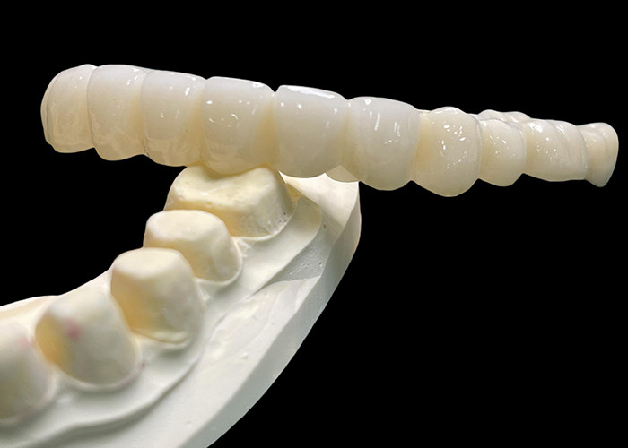 Vita Classical Shade All Ceramic Crown Bridge Tự nhiên Tìm kiếm phục hồi răng